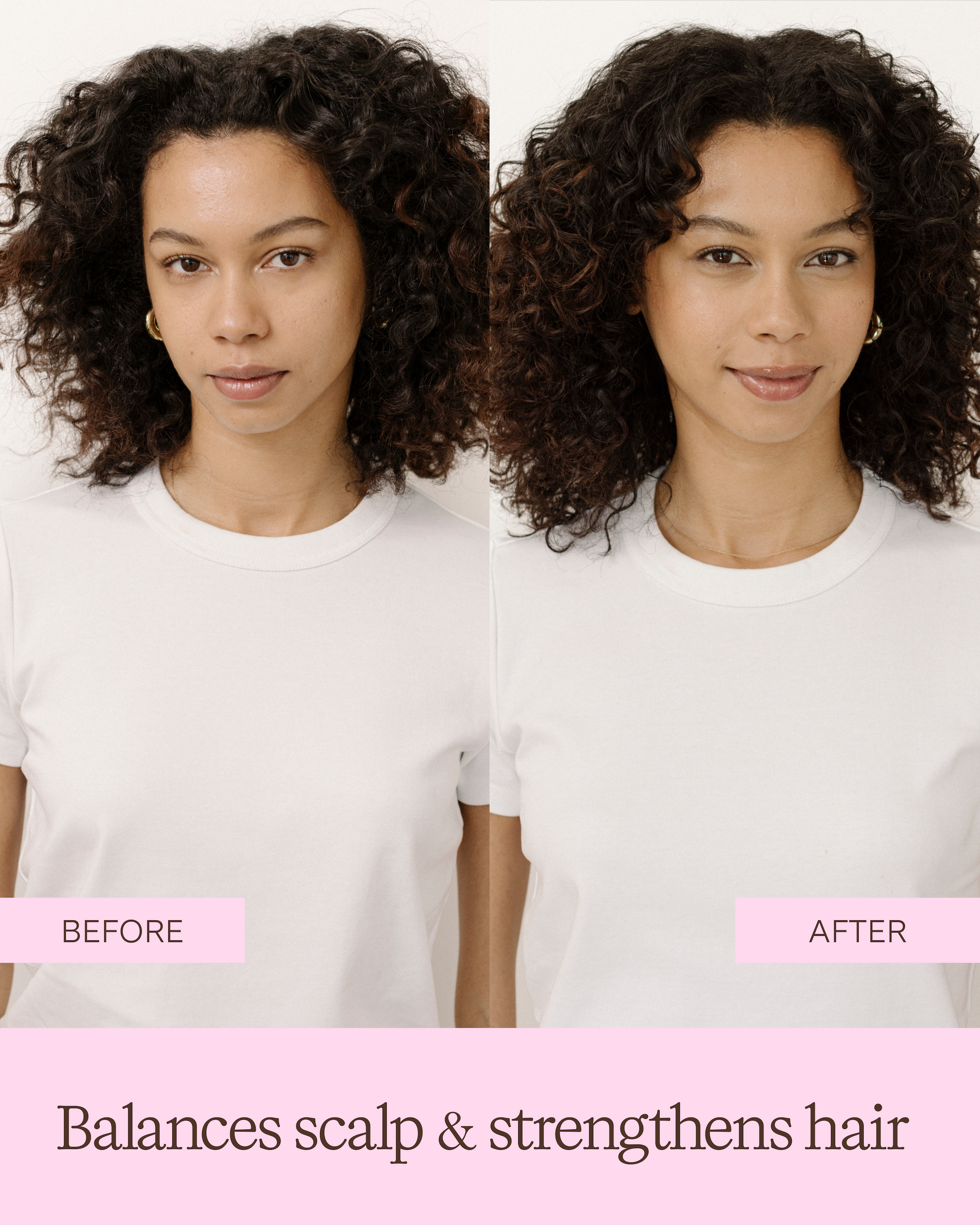 Before and after comparison of a woman with curly hair wearing a white shirt showing a balanced scalp and strengthened hair|variant:93-oz
